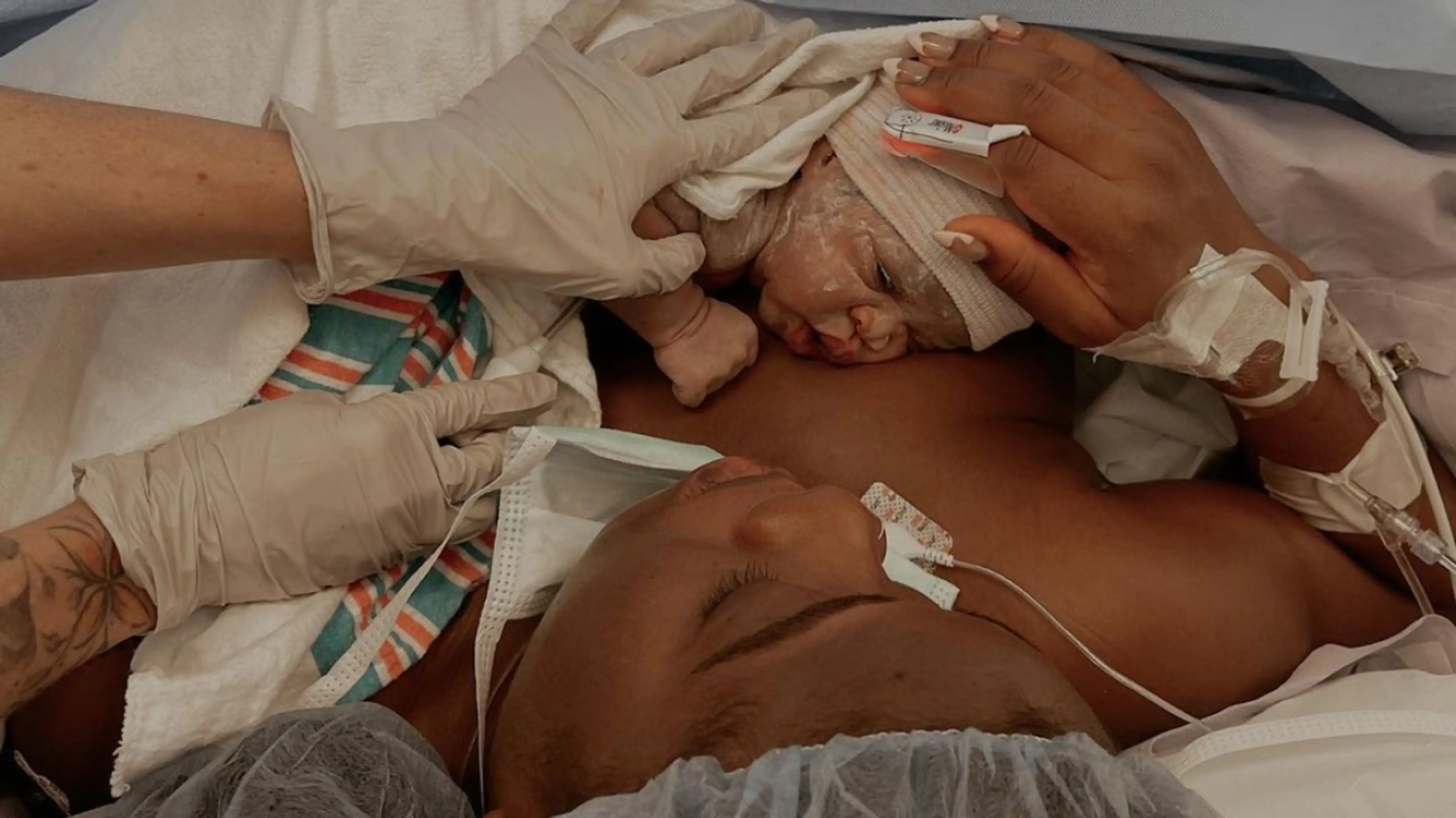 What to Know about C-Sections
